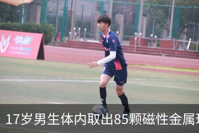 17岁男生体内取出85颗磁性金属珠子，医生：若延误治疗，极易导致尿道狭窄、膀胱穿孔甚至形成结石，将严重损害泌尿及生殖功能